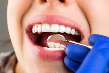 Dental check up